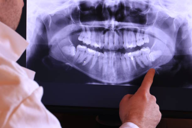 Best Walk-In Emergency Dental Services in Forreston, IL