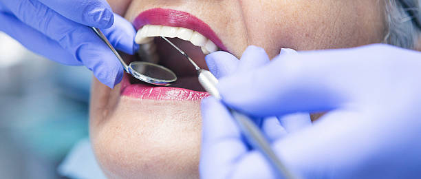 Best Broken or Chipped Tooth Repair in Forreston, IL